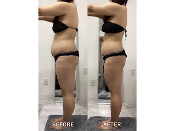 ナルシス/【痩身】5ヶ月の変化です★