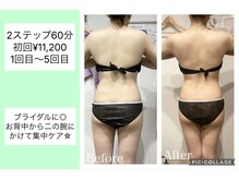 ハピネス(HAPPINESS)/背中、二の腕　1～5回目