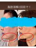 日本初上陸！韓国美容リポベラV★新導入キャンペーンモニター価格¥9,000→