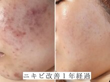 ユウビジン(YOU美人)/