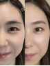 眉スタイリング（4week以内）