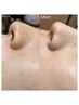 【プルツヤお肌！】フェイシャルWAX　最高級パック仕上げ付 ￥8800
