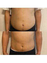 ビトタン 倉敷本店(+美to鍛)/男性のビール腹にも電磁パルス