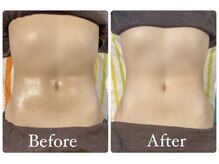 フルールドソレイユ(Fleur de Soleil)/当店自慢の腸美養セラピー☆彡