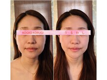 ウルワシ(Uruwashi)/★ビフォーアフター★