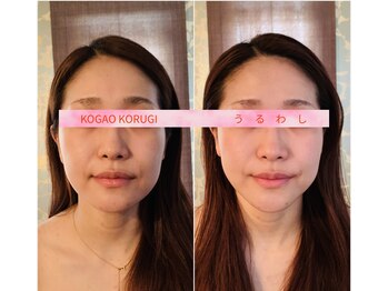 ウルワシ(Uruwashi)/★ビフォーアフター★