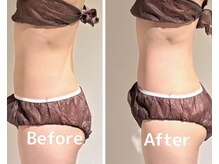 美活ラボ(美活LABO)/ビフォーアフター