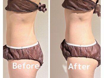 美活ラボ(美活LABO)/ビフォーアフター