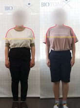 やまうら整骨院/山浦式美容整体の効果