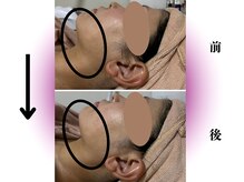 カリアンヌ/全身ボディ＆フェイシャルリンパ