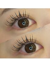 アイラ 本店(EYELA)/リフエク120本