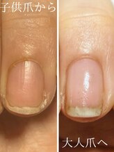 自爪育成プライベートサロン　Reginanail【レジーナネイル】/子供ぽい爪から縦長の大人爪へ
