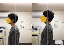 大砂土治療院/肩こり眼精疲労に鍼灸マッサージ