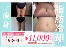エノアシュエット(Enoachouette)