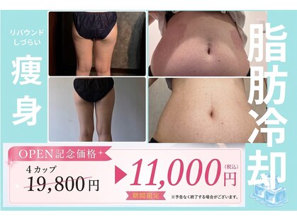 エノアシュエット(Enoachouette)の写真