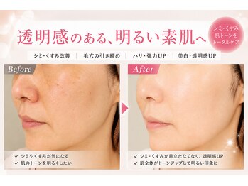 ラシクビューティールームの写真/シミ・くすみ・乾燥が気になる大人女性へ。透明感ケア
