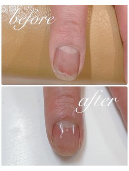 ジル アイラッシュアンドネイル(Jill)/☆ネイル補修☆