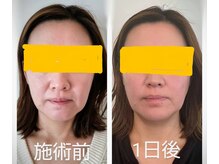 カレーズ 夙川店(Karez)/1日後の変化