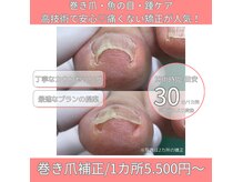 巻き爪補正店 宇都宮店