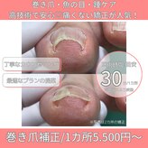巻き爪補正店 宇都宮店