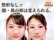 ラプリボーテ(Raplit BEAUTE)