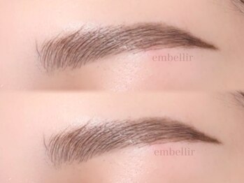 アンベリール(embellir)/＊ハリウッドブロウリフト