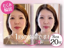 ネルジム 札幌店(NERU GYM)/むくみは一撃です！