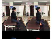 ストレチックス 近江八幡店/頭痛に悩む肩こり撃破！！