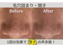 メディカルエステサロン ローズ 金沢本店(ROSE)の雰囲気（一人ひとりに合ったオーダーメイド施術で感動の結果へ）