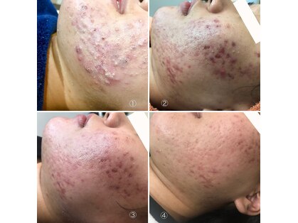 ヴィヴィ(ViVi)の写真