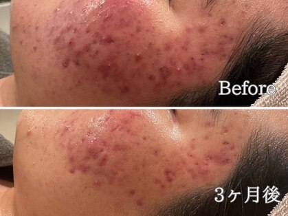 ポポラス(POPOLUS)の写真
