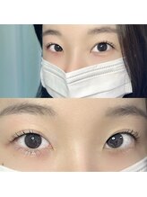 ジョリー(Jolie)/