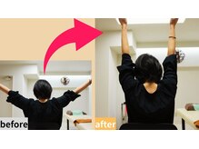 ゆうバランス(ゆうbalance)/整体ビフォーアフター