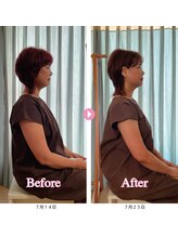 スピロソフィア/全身調整＋美容鍼