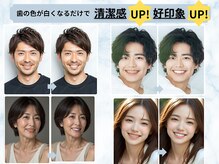 ホワイトニングショップ 長崎時津店の雰囲気（歯の色が変わるだけで、清潔感UP!好印象を与えられます♪）