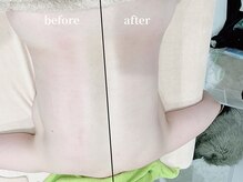 アンドゥ(Undo)/むくみ、老廃物をドバドバ流す