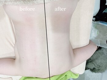 アンドゥ(Undo)/むくみ、老廃物をドバドバ流す