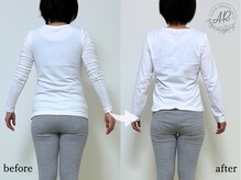 エーアール(AR)/【Before/After】6回目