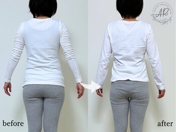 エーアール(AR)/【Before/After】6回目