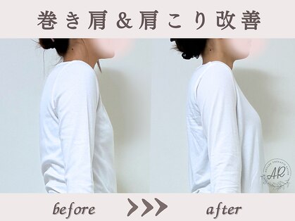 エーアール(AR)の写真