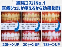 スマイルホワイト 練馬店