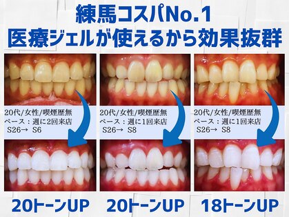 スマイルホワイト 練馬店の写真