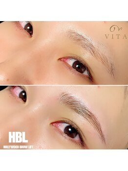 ヴィータ(VITA)/ハリウッドブロウリフト