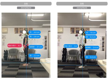 ナオル整体 池尻大橋院(NAORU整体)/1ヶ月週1通院での効果<30代女性>