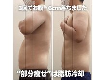 エアリアル 武雄店の雰囲気（理論に基づいた脂肪冷却技術で脂肪が戻らない！結果に自信あり！）