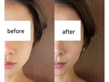 ムーンライズ(moonrise)/