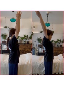 リセットモア(Reset More)/before after 1回の施術で