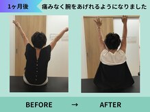 トミーリハ整体院(TOMMY REHA整体院)/肩の痛み改善