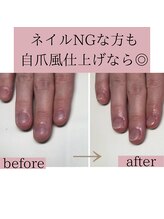 ティアラネイル 宇都宮/深爪矯正