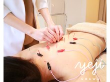 イエジ 浦和(Yeji)/◆鍼灸◆頑固な肩こりに